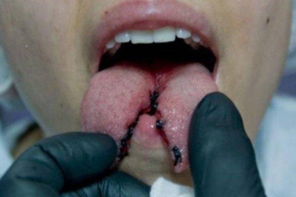 1353535935_tongue-splitting_19.jpg