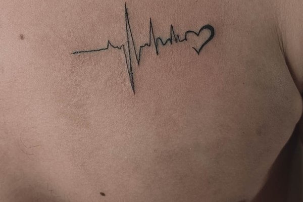 20250311-5dc48f20fa0877a064c9aec0a8f4b7c0