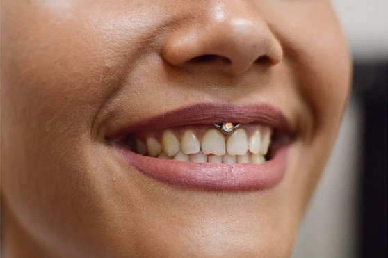 pirsing-smile4.jpg
