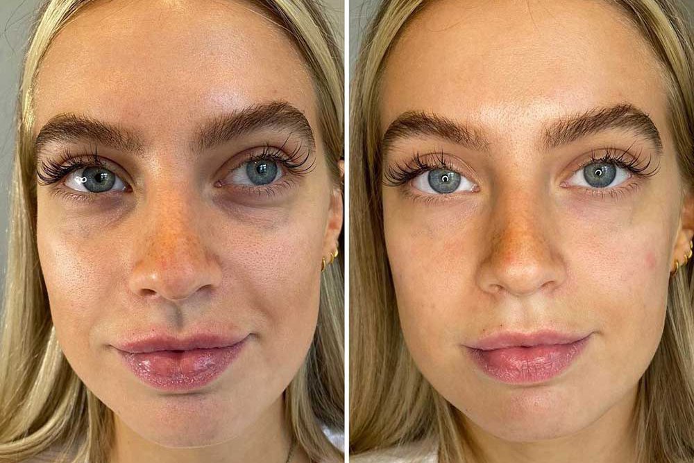 the.contour.queen_.jpg